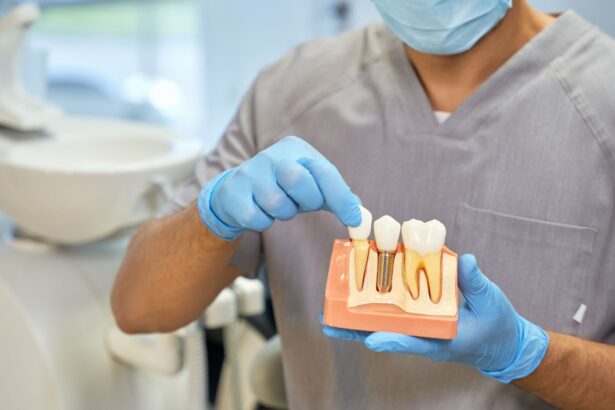 Do Dental Insurance Plans Cover Porcelain Veneers